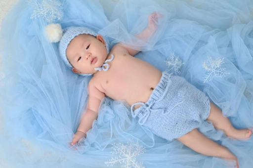 仙桃宝宝间歇性斜视